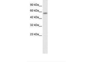 Image no. 1 for anti-Kelch-Like 36 (KLHL36) (AA 134-183) antibody (ABIN202817) (KLHL36 抗体  (AA 134-183))