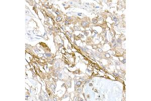 Immunohistochemistry (IHC) image for anti-Collagen, Type I, alpha 1 (COL1A1) (AA 100-200) antibody (ABIN6138837)