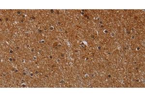 Immunohistochemistry of paraffin-embedded Human brain using CYP1A2 Polyclonal Antibody at dilution of 1:40 (CYP1A2 抗体)