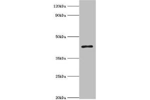 Western blot All lanes: 3-ketoacyl-CoA thiolase, peroxisomal antibody at 8 μg/mL + Mouse liver tissue Secondary Goat polyclonal to rabbit IgG at 1/10000 dilution Predicted band size: 45, 35 kDa Observed band size: 45 kDa (ACAA1 抗体  (AA 27-300))