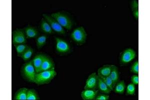 Immunofluorescent analysis of A549 cells using ABIN7174759 at dilution of 1:100 and Alexa Fluor 488-congugated AffiniPure Goat Anti-Rabbit IgG(H+L) (C17orf78 抗体  (AA 1-186))