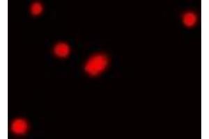 Immunofluorescence (IF) image for anti-Fibrillarin (FBL) antibody (ABIN7305926)