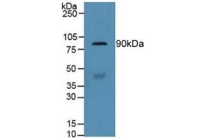 Detection of GSN in Human Serum using Polyclonal Antibody to Gelsolin (GSN) (Gelsolin 抗体  (AA 432-625))