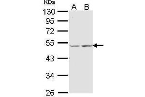 WB Image Sample (30 ug of whole cell lysate) A: A431 , B: Hela 10% SDS PAGE antibody diluted at 1:1000 (COX15 抗体  (Center))