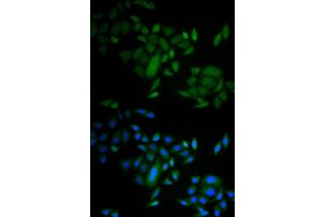 Immunofluorescence analysis of A549 cells using CASP9 antibody (ABIN5971434). (Caspase 9 抗体)