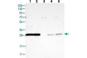Western blot analysis of Lane 1: RT-4, Lane 2: U-251 MG, Lane 3: Human Plasma, Lane 4: Liver, Lane 5: Tonsil with YWHAQ polyclonal antibody . (YWHAB 抗体)
