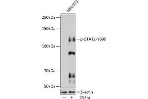 Western blot analysis of extracts of various cell lines, using Phospho-ST-Y690 pAb (ABIN3020024, ABIN3020025, ABIN3020026 and ABIN6225501) at 1:1000 dilution. (STAT2 抗体  (pTyr690))