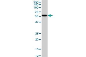 CDK8 monoclonal antibody (M01), clone 6H5. (CDK8 抗体  (AA 375-464))