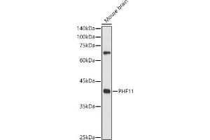 Western blot analysis of extracts of Mouse brain, using PHF11 antibody (ABIN6128437, ABIN6145533, ABIN6145535 and ABIN6217420) at 1:500 dilution. (PHF11 抗体  (AA 1-292))