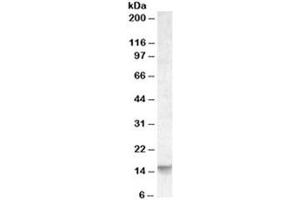 Western blot testing of human cerebellum lysate with Noxa antibody at 0. (NOXA 抗体)