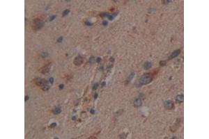 IHC-P analysis of Human Tissue, with DAB staining. (CNDP1 抗体  (AA 332-507))
