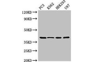 Western Blot Positive WB detected in: PC-3 whole cell lysate, K562 whole cell lysate, HEK293 whole cell lysate, U87 whole cell lysate All lanes: SLAMF1 antibody at 3 μg/mL Secondary Goat polyclonal to rabbit IgG at 1/50000 dilution Predicted band size: 38, 34, 41 kDa Observed band size: 38 kDa (SLAMF1 抗体  (AA 69-204))