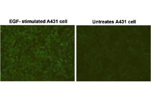 Immunofluorescent staining of EGF-stimulated A431 cells and untreated A431 cells with Phosphotyrosine monoclonal antibody, clone E10 . (Phosphotyrosine 抗体)
