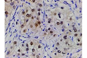 Immunohistochemistry (IHC) image for anti-Cofilin 1 (CFL1) (pSer3) antibody (ABIN6255180)