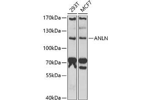 Western blot analysis of extracts of various cell lines, using ANLN antibody (ABIN6127346, ABIN6136899, ABIN6136900 and ABIN6222181) at 1:1000 dilution. (Anillin 抗体  (AA 845-1124))