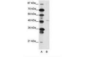 Image no. 1 for anti-Mesenchyme Homeobox 2 (MEOX2) (N-Term) antibody (ABIN202200) (MEOX2 抗体  (N-Term))