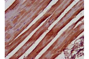 IHC image of ABIN7152702 diluted at 1:500 and staining in paraffin-embedded human skeletal muscle tissue performed on a Leica BondTM system. (FERMT2 抗体  (AA 155-232))