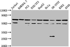 Western Blot Positive WB detected in: Jurkat whole cell lysate, RAW264. (NUP62 抗体  (AA 173-522))