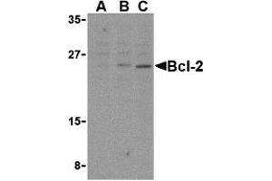 Western Blotting (WB) image for anti-B-Cell CLL/lymphoma 2 (BCL2) (Middle Region) antibody (ABIN1030884) (Bcl-2 抗体  (Middle Region))
