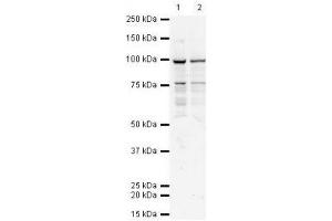 Image no. 1 for anti-Transporter 1, ATP-Binding Cassette, Sub-Family B (MDR/TAP) (TAP1) antibody (ABIN108593) (TAP1 抗体)