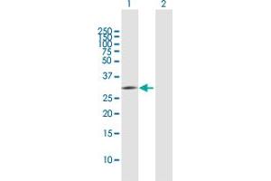 Western Blot analysis of PNO1 expression in transfected 293T cell line by PNO1 MaxPab polyclonal antibody. (PNO1 抗体  (AA 1-252))