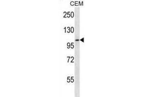 Western Blotting (WB) image for anti-Rhomboid 5 Homolog 2 (RHBDF2) antibody (ABIN5017025) (RHBDF2 抗体)