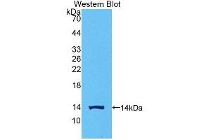 Detection of Recombinant CGb1, Human using Polyclonal Antibody to Chorionic Gonadotropin Beta Polypeptide 1 (CGb1) (CGB 抗体  (AA 55-153))