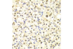 Immunohistochemistry of paraffin-embedded rat heart using DDB2 antibody at dilution of 1:100 (x400 lens). (DDB2 抗体)