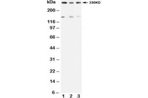 Western blot testing of ATM antibody and Lane 1:  rat testis;  2: U87;  3: MCF-7 (ATM 抗体  (N-Term))