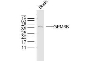 Mouse brain lysates probed with GPM6B Polyclonal Antibody, unconjugated  at 1:300 overnight at 4°C followed by a conjugated secondary antibody at 1:10000 for 90 minutes at 37°C. (GPM6B 抗体  (AA 1-100))