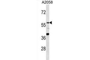 Western Blotting (WB) image for anti-Zinc Finger Protein 776 (ZNF776) antibody (ABIN3000161)