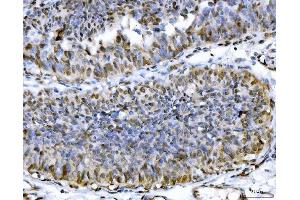 IHC analysis of ACLY using anti-ACLY antibody (ABIN4886416). (ACLY 抗体  (AA 1-180))