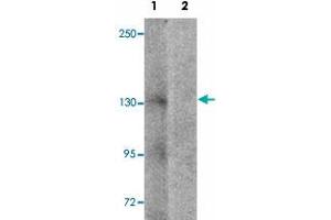 Western blot analysis of NLRP7 in human brain tissue lysate with NLRP7 polyclonal antibody  at 1 ug/mL in (1) the absence and (2) the presence of blocking peptide.