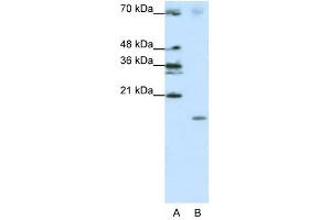 SRP19 antibody used at 1. (SRP19 抗体  (Middle Region))