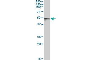 PAX8 monoclonal antibody (M09), clone 3H7. (PAX8 抗体  (AA 1-450))