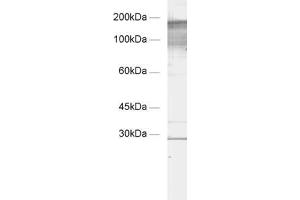 dilution: 1 : 1000, sample: crude synaptic membranes fraction of rat brain (LP1) (Regulating Synaptic Membrane Exocytosis 1 (RIMS1) (AA 955-1156) 抗体)