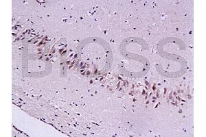 Formalin-fixed and paraffin embedded rat brain tissue labeled with Anti-Cygb Polyclonal Antibody (ABIN670566), Unconjugated at 1:200, followed by conjugation to the secondary antibody and DAB staining (CYGB 抗体  (AA 87-132))