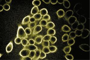 Immunofluorescent staining of Hela cells (Human cervical epitheloid carcinoma, ATCC CCL-2. (SPTBN1 抗体  (AA 2101-2189))