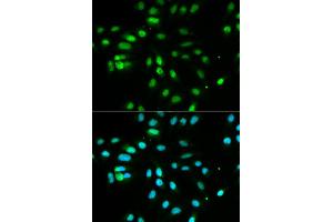 Immunofluorescence analysis of MCF7 cell using PAX3 antibody. (Paired Box 3 抗体)