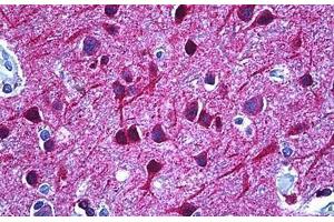 Human Brain, Cortex: Formalin-Fixed, Paraffin-Embedded (FFPE) (DPYSL2 抗体  (AA 480-529))