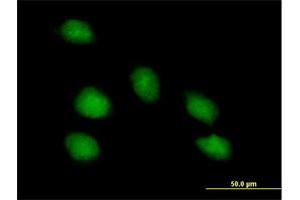 Immunofluorescence of purified MaxPab antibody to PNMA1 on HeLa cell. (PNMA1 抗体  (AA 1-353))