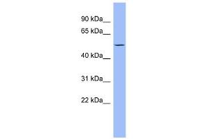 PTK6 antibody used at 1 ug/ml to detect target protein. (PTK6 抗体  (Middle Region))