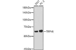 Western blot analysis of extracts of various cell lines, using TRPV6 antibody (ABIN7270921) at 1:1000 dilution. (TRPV6 抗体  (AA 1-100))