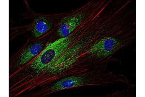 Immunofluorescence staining of Syk in human primary fibroblasts using anti-Syk (; green). (SYK 抗体  (AA 5-360))