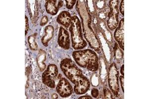 Immunohistochemical staining of human kidney with EARS2 polyclonal antibody  shows strong cytoplasmic positivity in renal tubules at 1:10 - 1:20 dilution. (EARS2 抗体)