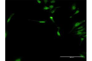 Immunofluorescence of purified MaxPab antibody to DYX1C1 on HeLa cell. (DYX1C1 抗体  (AA 1-381))