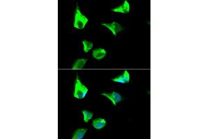Immunofluorescence analysis of HeLa cell using RRM1 antibody. (RRM1 抗体  (AA 593-792))