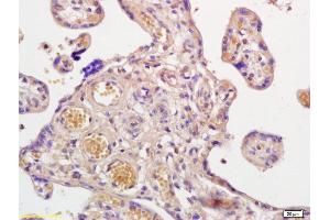 Immunohistochemistry (IHC) image for anti-Prostaglandin E Receptor 2 (Subtype EP2), 53kDa (PTGER2) (AA 271-358) antibody (ABIN755248)