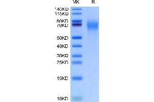 Cynomolgus CD200 R1 on Tris-Bis PAGE under reduced condition. (CD200R1 Protein (AA 25-267) (His tag))