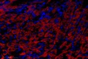 Immunofluorescent analysis of paraformaldehyde-fixed mouse stomach using Epsin-3 (ABIN7073856) at dilution of 1: 1400 (EPN3 抗体)